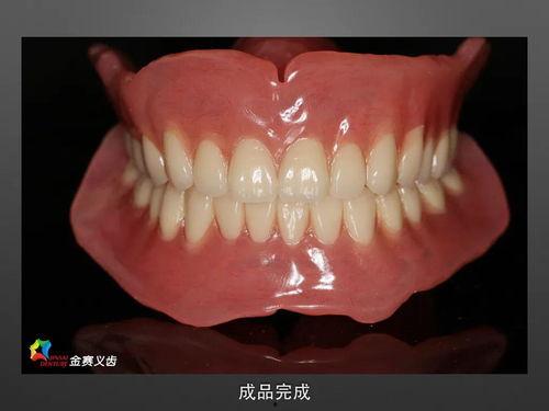 国产全瓷牙如何制备视频